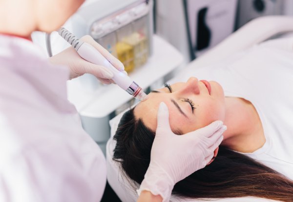 Limpieza Facial Profunda con H₂O₂