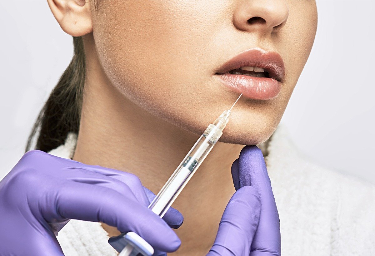 Aumento de labios